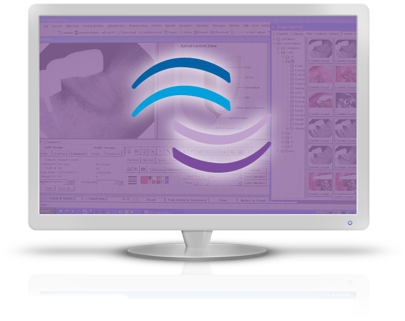TDO software