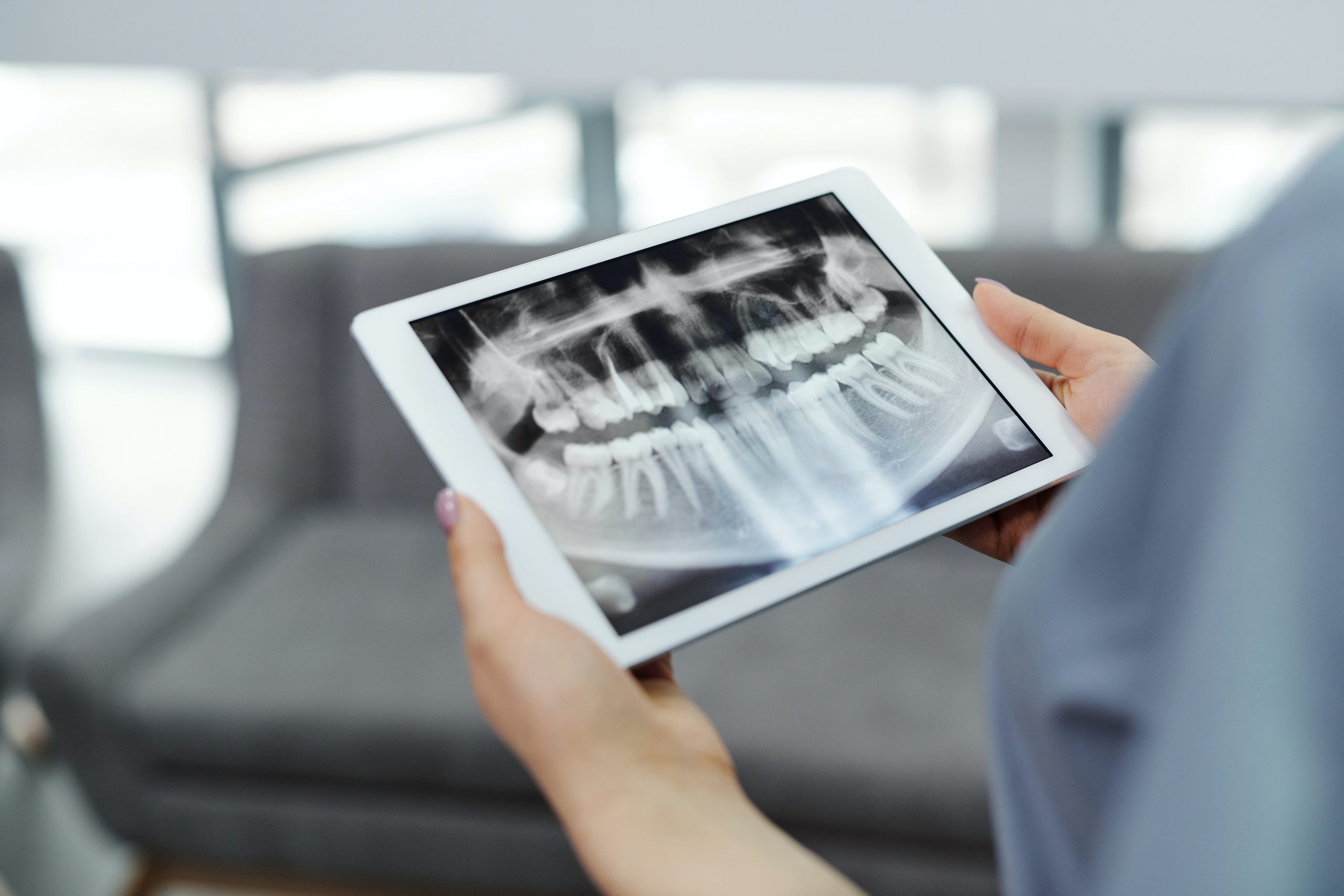 digital radiography sample